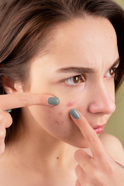 Acne Answers: Finally Clear Skin Without the Fuss